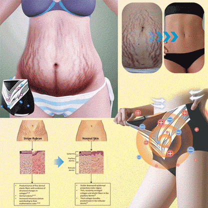 Medical Grade Titanium Fiber Tourmaline Shaping Shorts👙