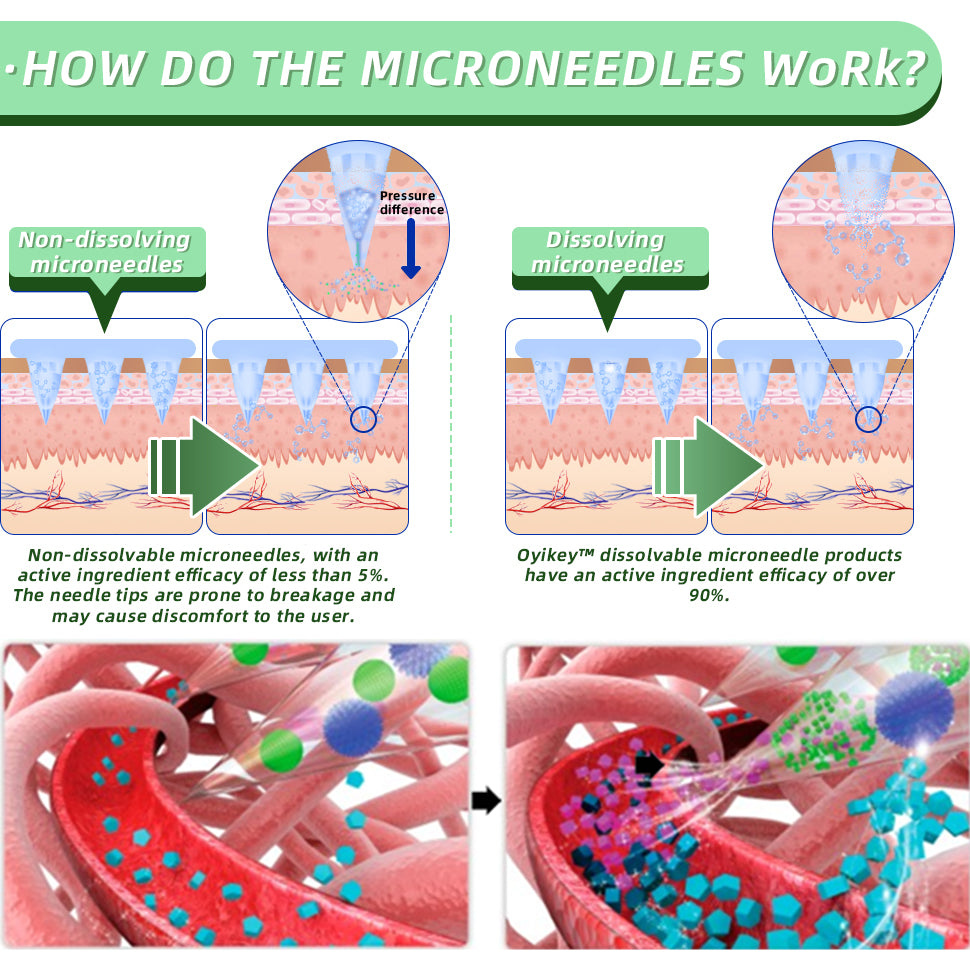 [See results in 7 days]✨Lenreey®  SMGT-GLP-1 Nano Microneedle Patch（Painless, long-lasting, addressing diabetes, obesity, and cardiovascular diseases）🇦🇺