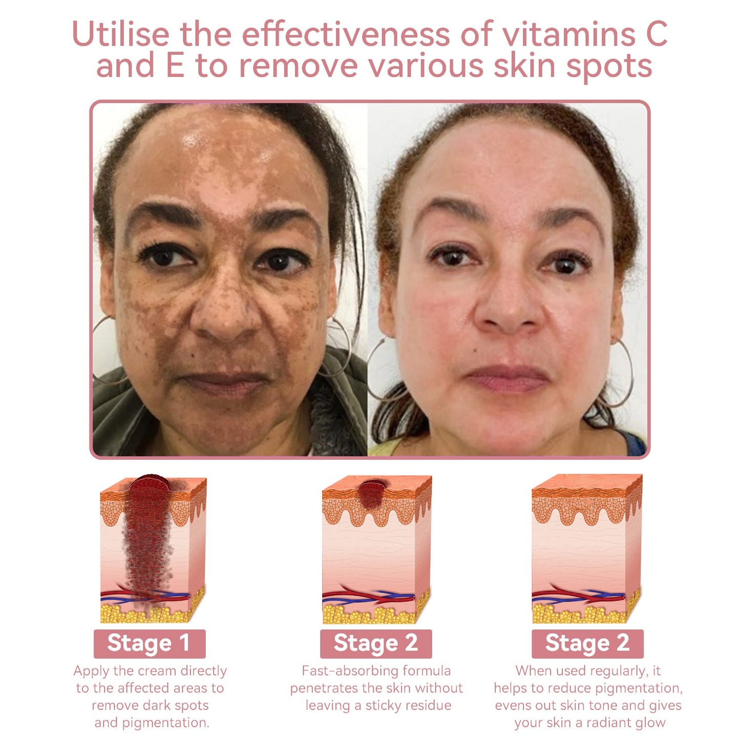 Coenzyme Q10 Collagen Jelly Skin Cream--Christmas promotion, up to 80% discount, American News reported products