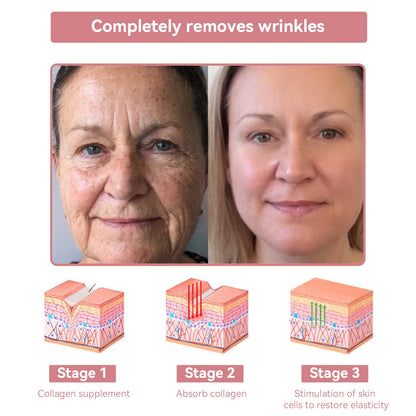 Coenzyme Q10 Collagen Jelly Skin Cream--Christmas promotion, up to 80% discount, American News reported products