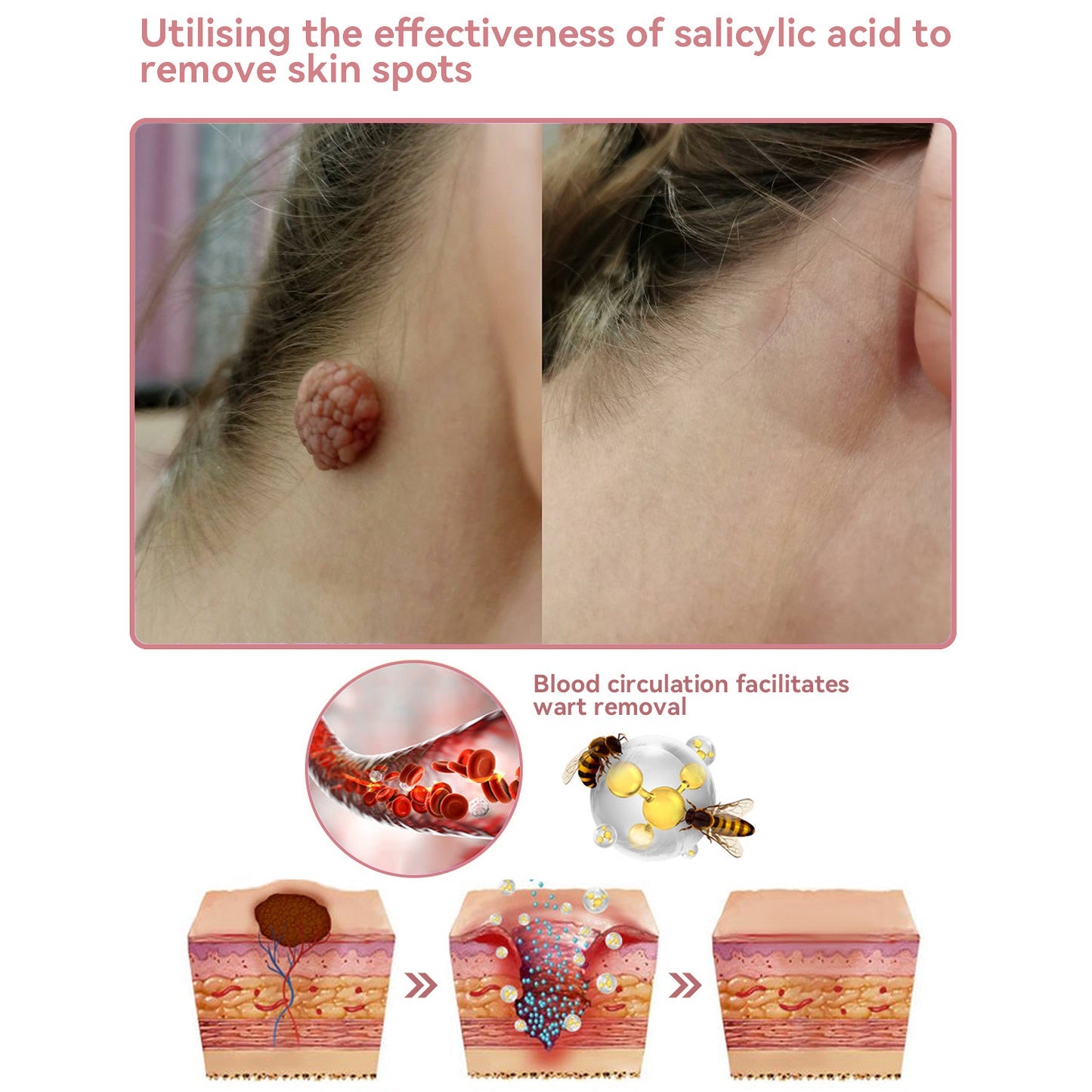 Coenzyme Q10 Collagen Jelly Skin Cream--Christmas promotion, up to 80% discount, American News reported products