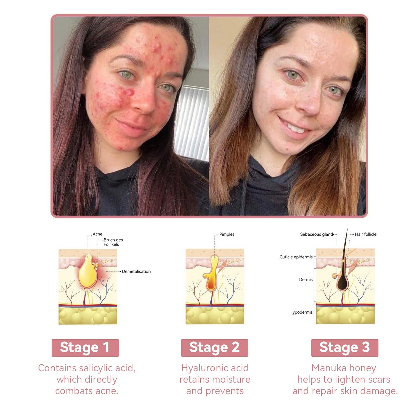 Coenzyme Q10 Collagen Jelly Skin Cream--Christmas promotion, up to 80% discount, American News reported products