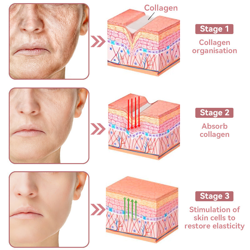 Coenzyme Q10 Collagen Jelly Skin Cream--Christmas promotion, up to 80% discount, American News reported products