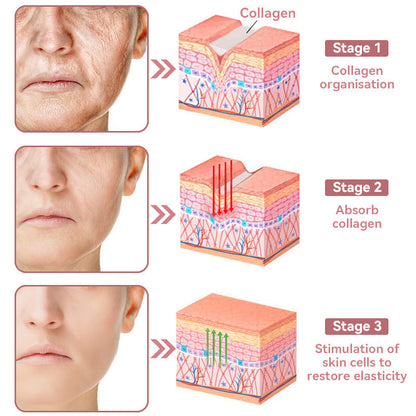 Coenzyme Q10 Collagen Jelly Skin Cream--Christmas promotion, up to 80% discount, American News reported products
