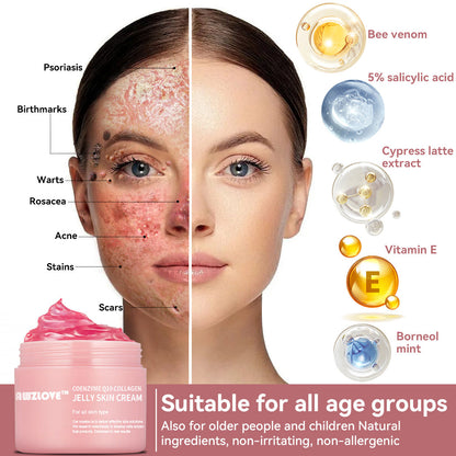 Coenzyme Q10 Collagen Jelly Skin Cream--Christmas promotion, up to 80% discount, American News reported products