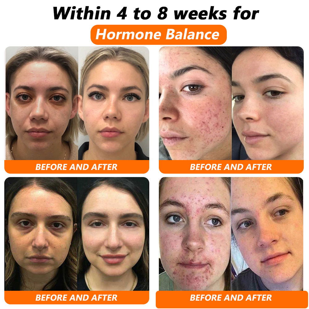 𝐋𝐞𝐧𝐫𝐞𝐞𝐲®𝐁𝐞𝐞 𝐕𝐞𝐧𝐨𝐦 𝐍𝐌𝐍 𝐍𝐚𝐭𝐮𝐫𝐚𝐥 𝐑𝐞𝐩𝐚𝐢𝐫 𝐕𝐚𝐠𝐢𝐧𝐚𝐥 𝐂𝐚𝐩𝐬𝐮𝐥𝐞𝐬 [𝐅𝐨𝐫 𝐚𝐥𝐥 𝐯𝐚𝐠𝐢𝐧𝐚𝐥 𝐚𝐧𝐝 𝐡𝐨𝐫𝐦𝐨𝐧𝐚𝐥 𝐩𝐫𝐨𝐛𝐥𝐞𝐦𝐬]  🌹